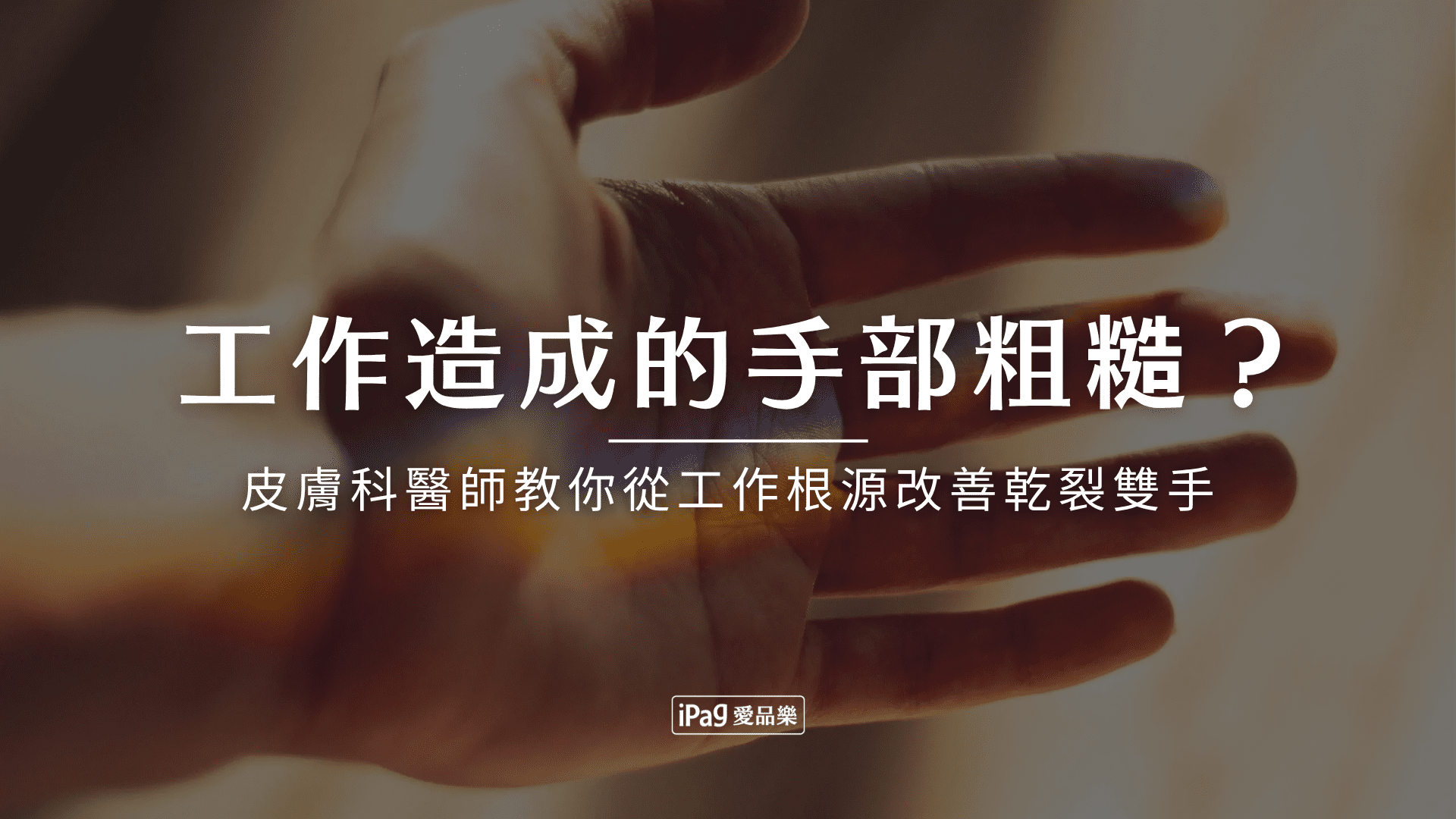 工作造成的手部粗糙