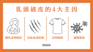乳頭破皮怎麼辦 4大主因